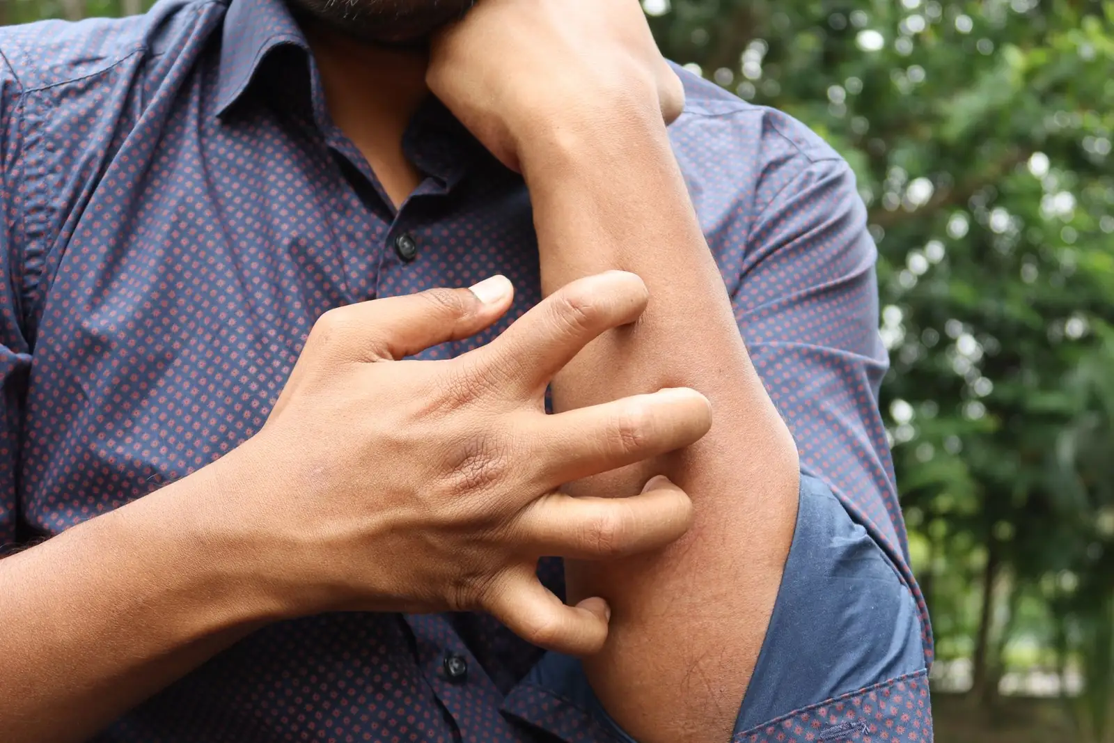 Allergic Reactions After Dental Work: What They Look Like and When to Call — Westlake Dental Care, Sterling VA