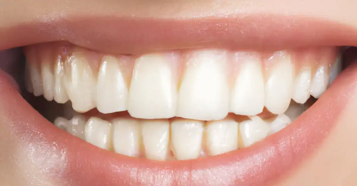 Are Whitening Strips Bad for Your Teeth? A Deep Dive into Teeth Whitening — Westlake Dental Care, Sterling VA