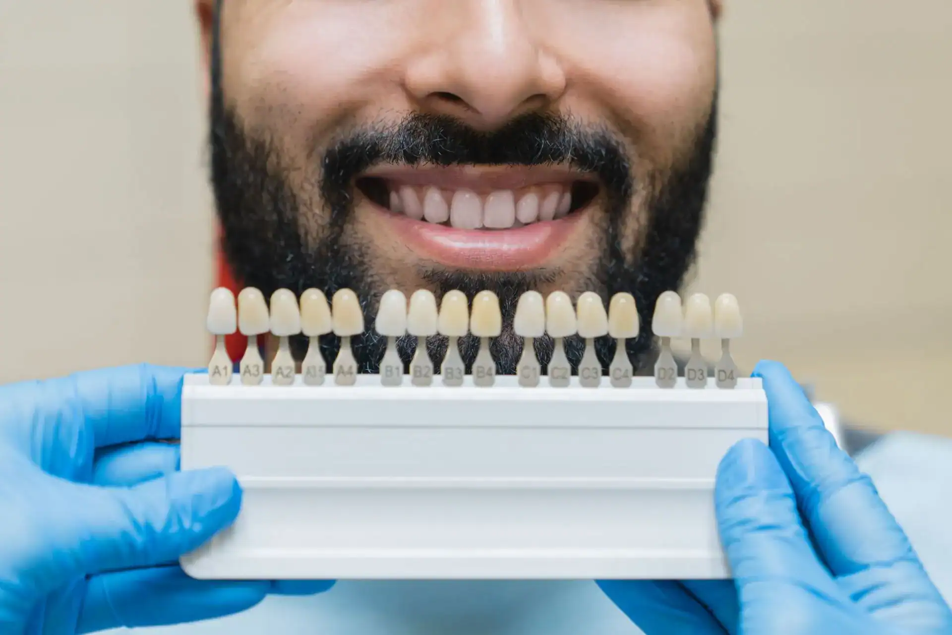 Best Type of Dental Veneers: The Different Types of Veneers — Westlake Dental Care, Sterling VA