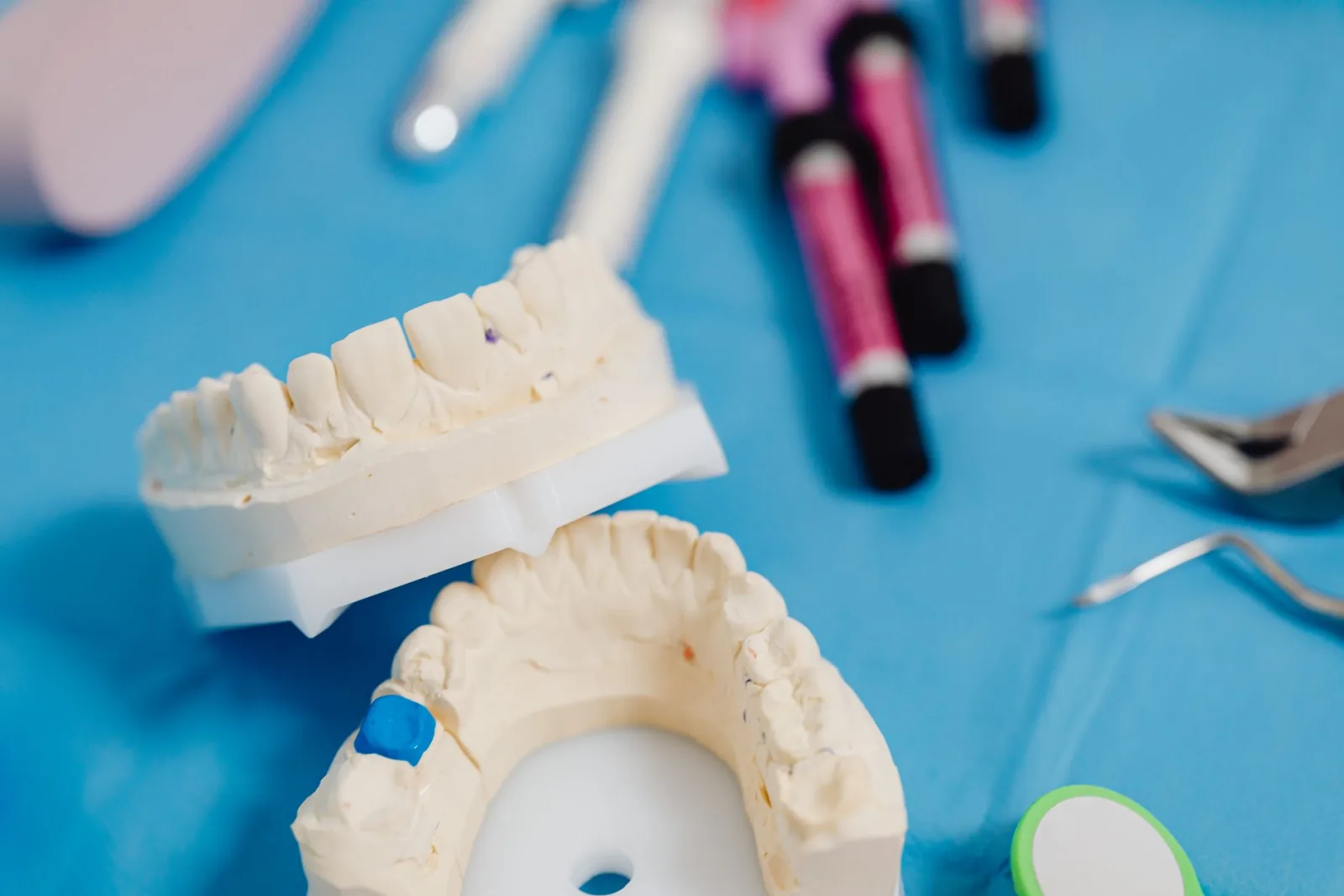 What a Dental Crown Costs in Sterling — Westlake Dental, Sterling VA