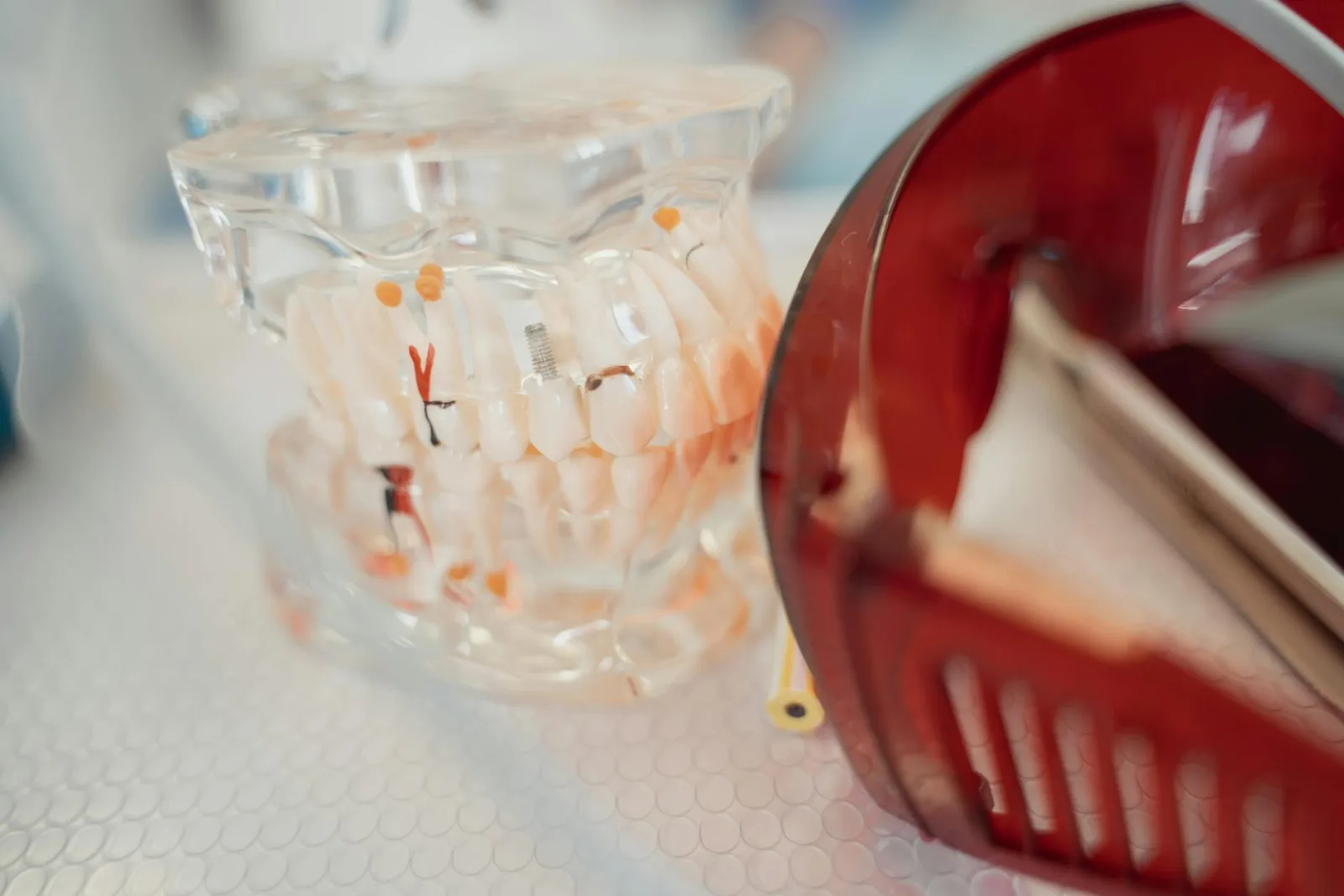 What Are Dental Flippers and Why Would I Need Them? — Westlake Dental, Sterling VA