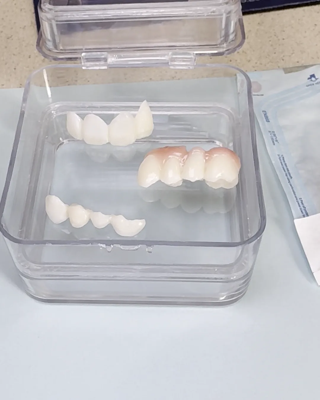 The 3D-printed mock-up pieces in their case, ready for the second visit