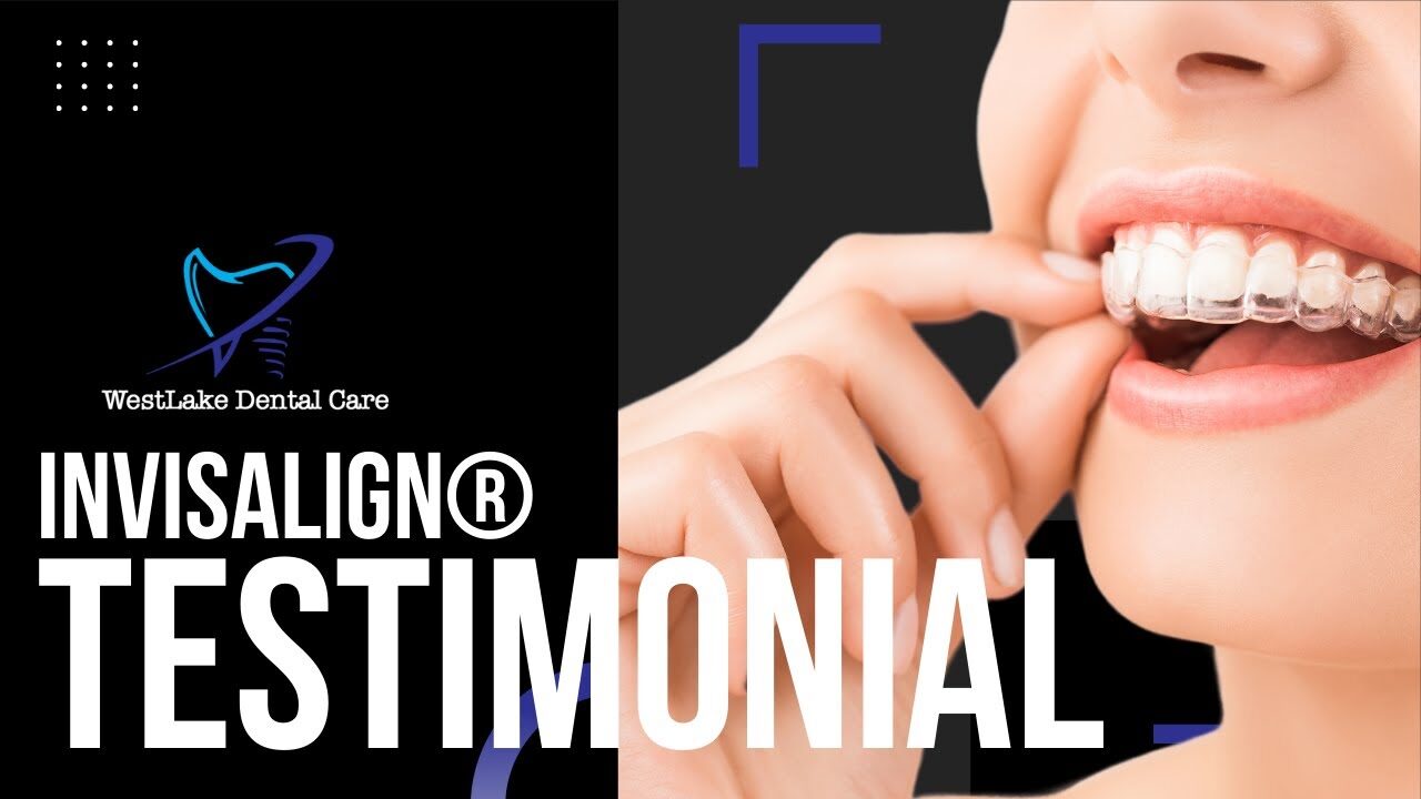 Andrew shares his Invisalign story
