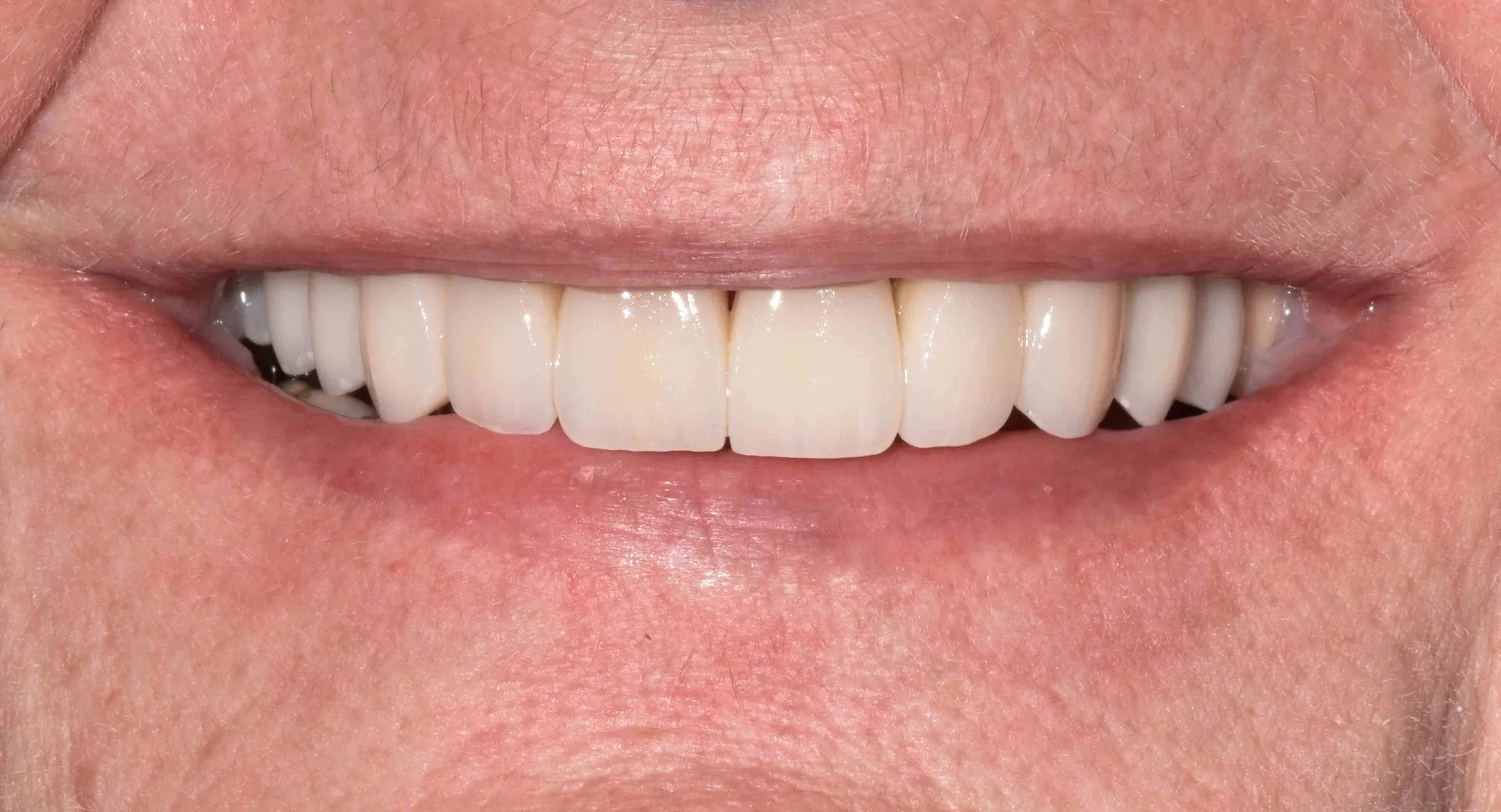 Close-up-final-smile-min-1920w Close-up-final-smile-min-1920w