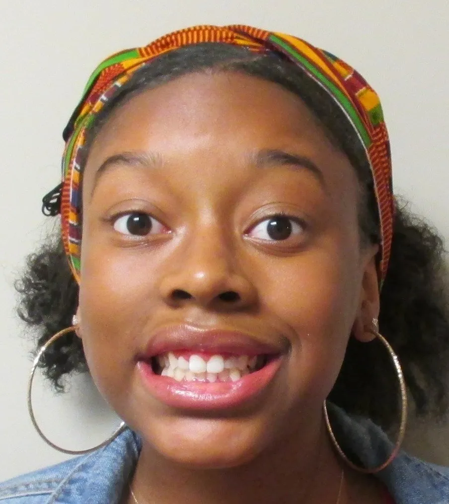 erin-sills-post-op-(facial)-min-1920w erin-sills-post-op-(facial)-min-1920w