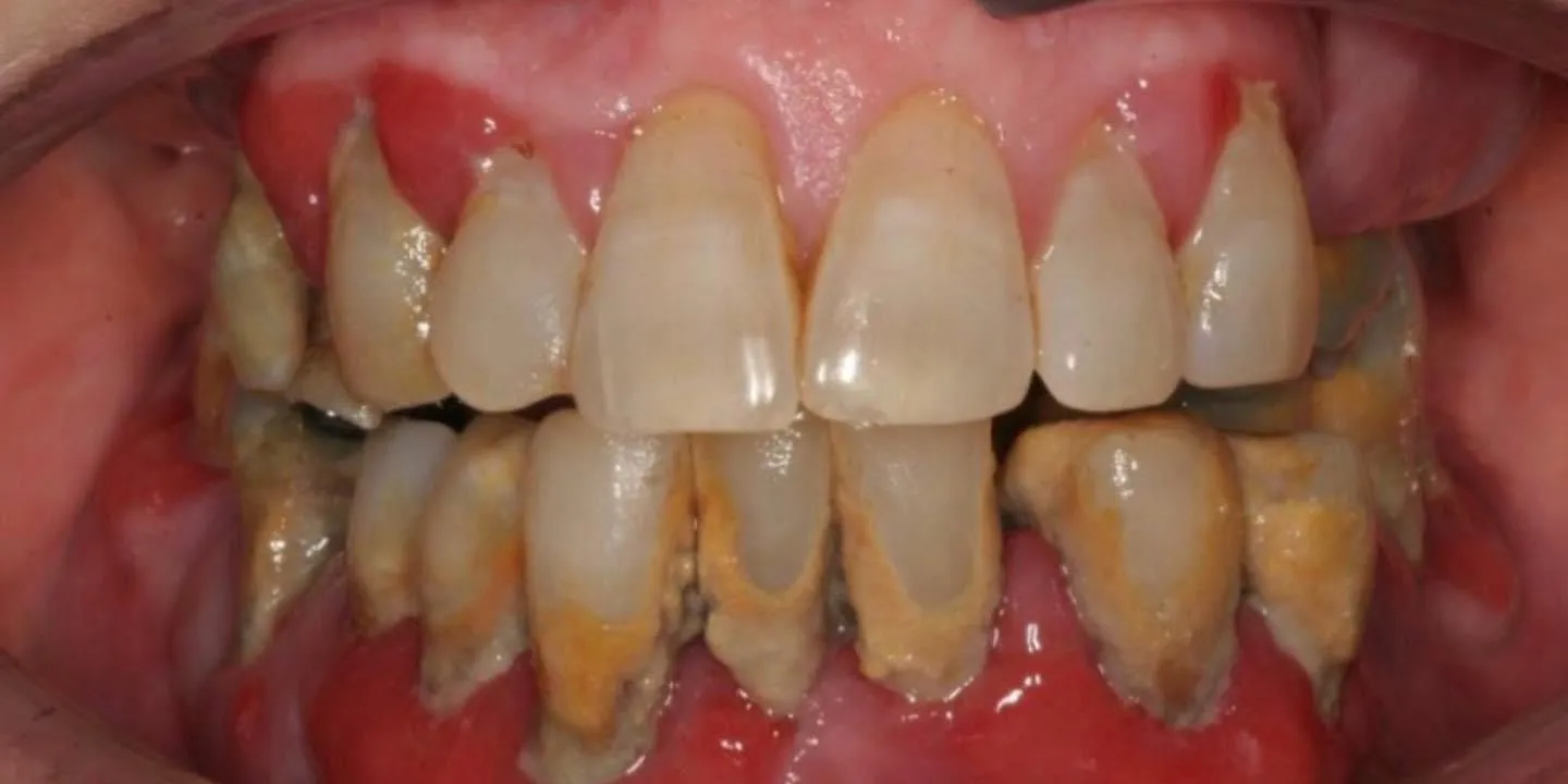 pre-post-1-1920w pre-post-1-1920w