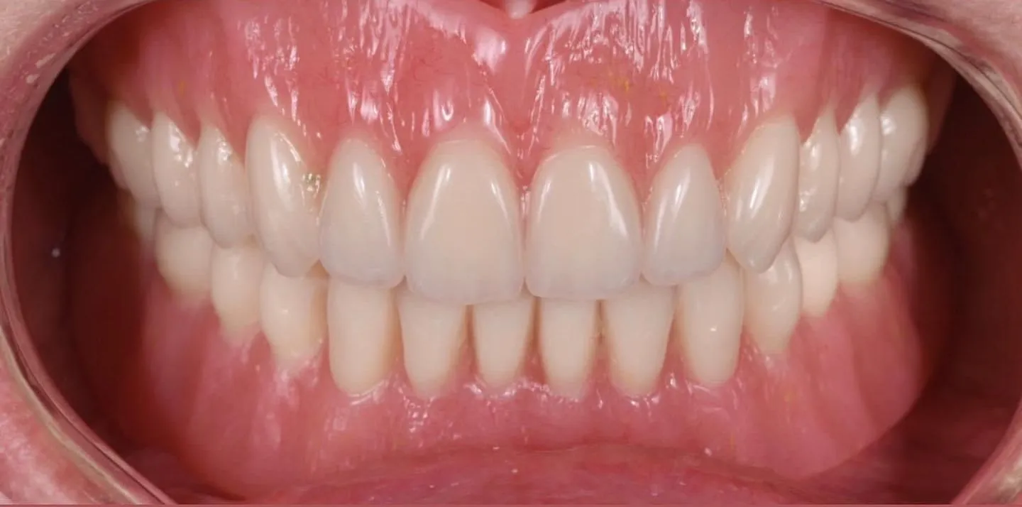 pre-post-1-d840c46d-1920w pre-post-1-d840c46d-1920w